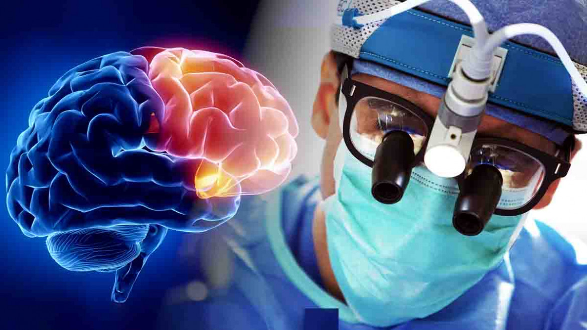 Biopsia cerebral