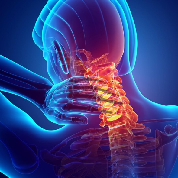 Discopatía Cervical Degenerativa