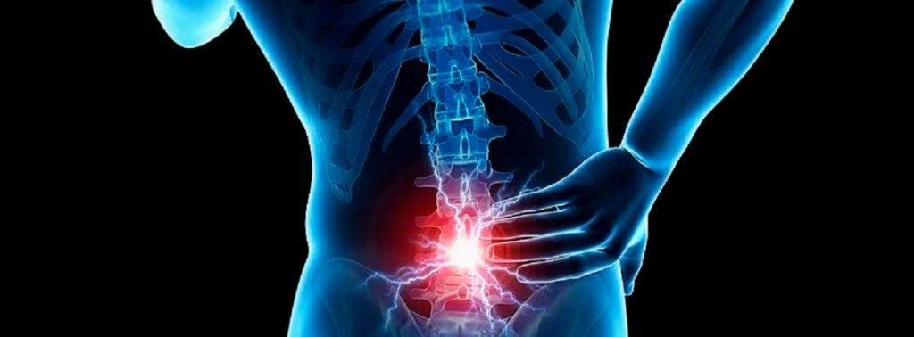 Discopatia Lumbar Degenerativa