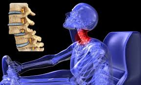 Luxación Vertebral