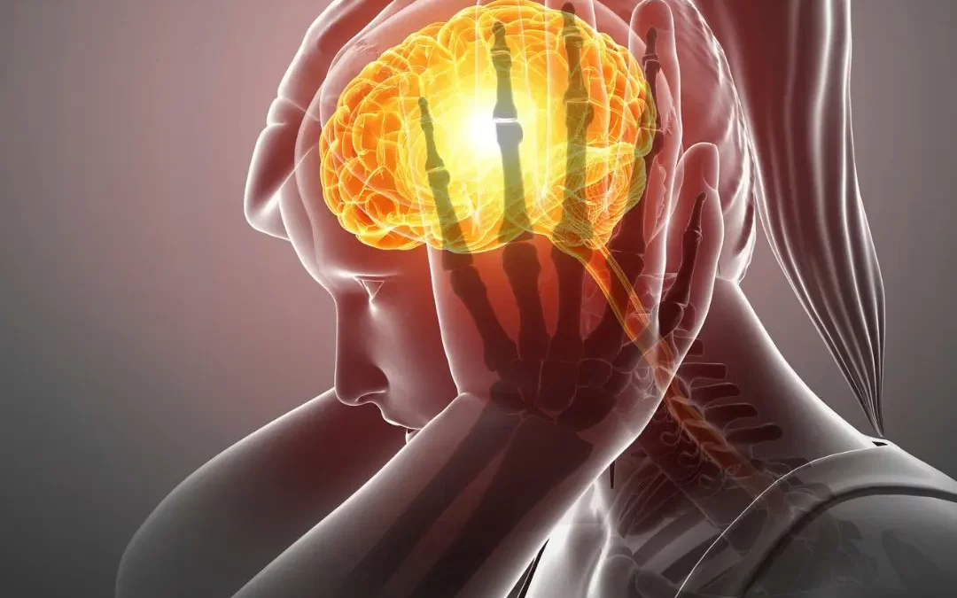 Conoce los factores que desencadenan la migraña