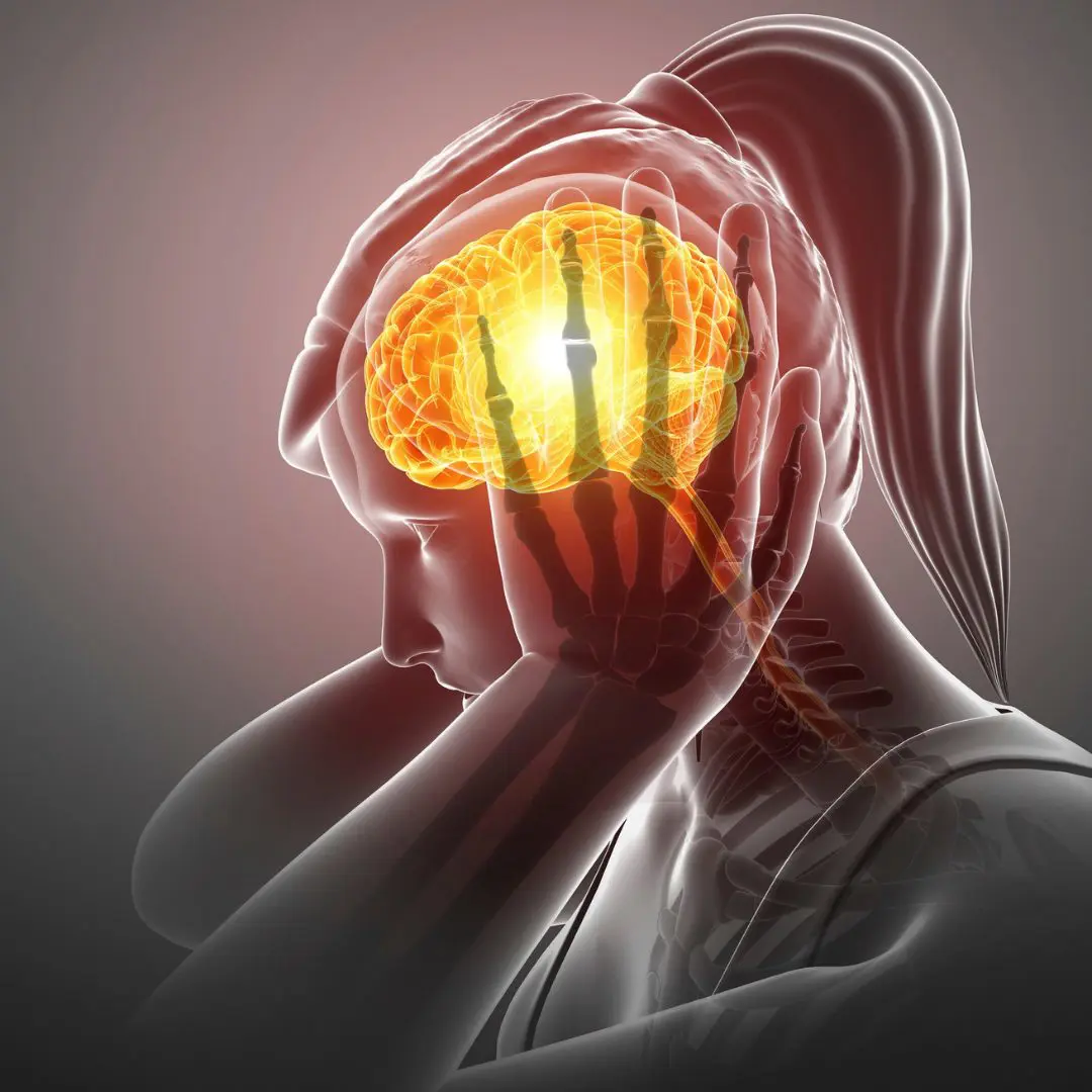 Conoce los factores que desencadenan la migraña