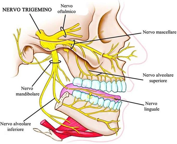Neuralgia del Trigémino