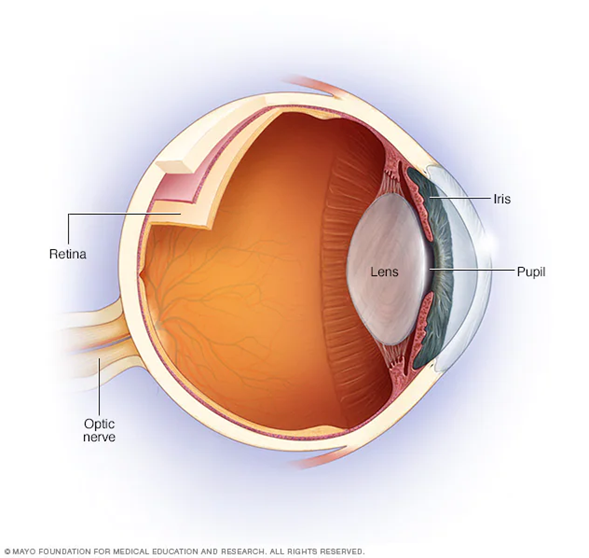 Neuritis Óptica