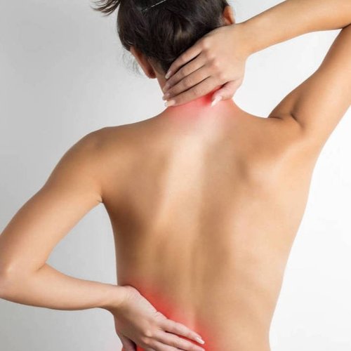 Escoliosis
